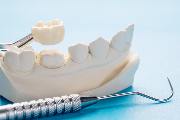 Dental Crown Beaverton OR