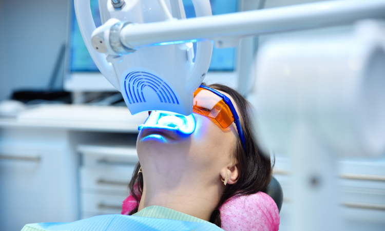 Why Choose Professional Teeth Whitening