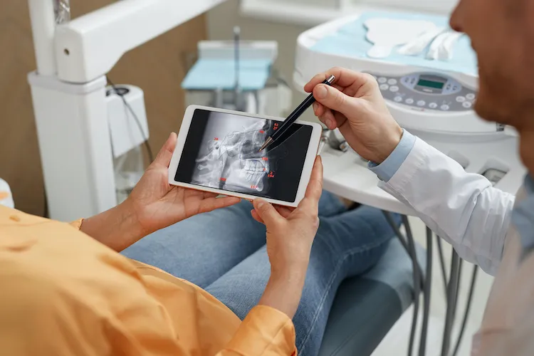 You Might Have a Cavity Even If It Doesn't Hurt in Beaverton, OR